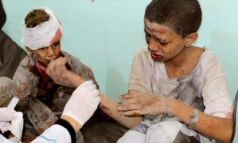 Photo of ‘La ONU solo habla de niños yemeníes, no toma medidas’