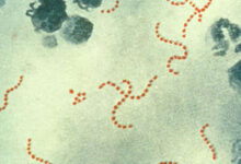 Photo of Japón registra cifras récords de infección por un estreptococo ‘carnívoro’ letal